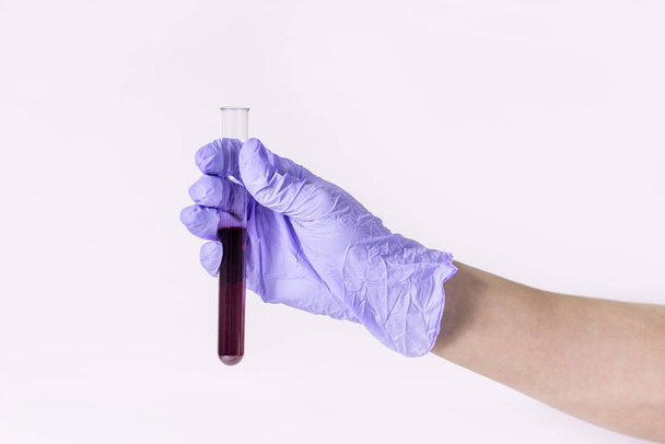 The hand in a blue medical glove is holding test tube with result of blood on the coronavirus. A new epidemic of the Chinese virus. The concept of passing the analysis for 2019 is nCoV. Copy space. - Foto, Bild