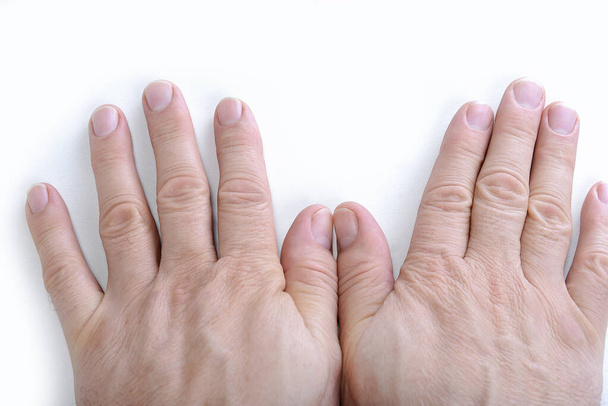 Blanke mannelijke hand tonen nagels op witte achtergrond - Foto, afbeelding