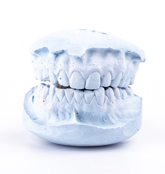 molde de dientes
 - Foto, Imagen