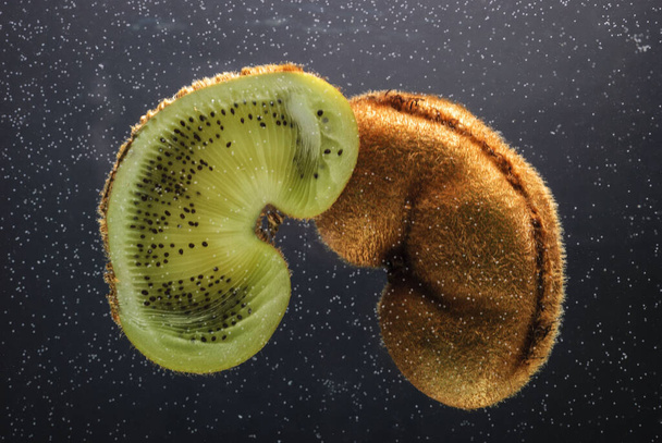 Kiwi vruchten, vergelijkbaar met de nieren. Niergezondheidsconcept. Promotiefoto. Kiwi doormidden gesneden, met luchtbellen, onder water, in de vorm van een nier. Genitaal systeem, anatomie. Een blanco voor een artikel over nierziekte. Nefrologie en  - Foto, afbeelding
