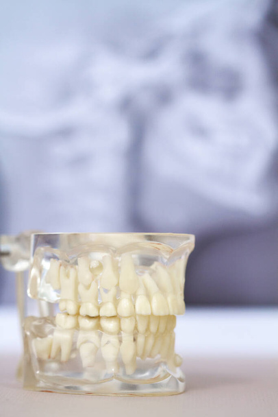 Ένα διαφανές μοντέλο της ανθρώπινης γνάθου με μόνιμα και φυλλοβόλα δόντια  - Φωτογραφία, εικόνα