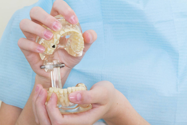 女性の手の歯科モデルの閉鎖。透明シリコーンとプラスチック歯2行目に見えるコネクタ付き。歯科研修のための人間の顎. - 写真・画像