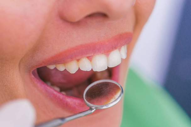Gros plan d'une patiente à bouche ouverte lors d'un bilan buccal chez le dentiste. - Photo, image