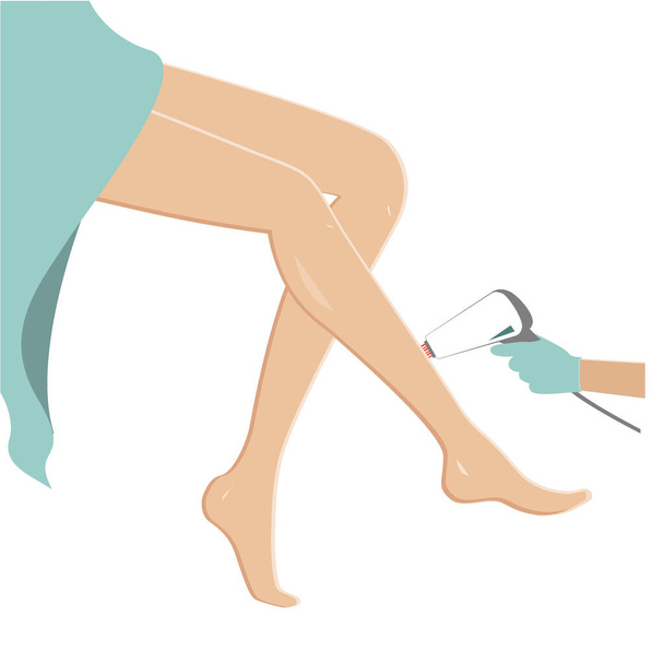 Female legs hair removal. Laser epilation concept, vector illustration - Διάνυσμα, εικόνα