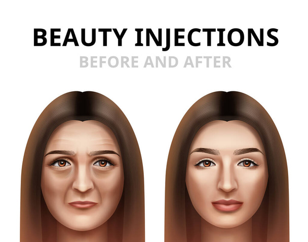 Realista antes e depois ilustração vetorial da mulher ter injeção de beleza facial
. - Vetor, Imagem