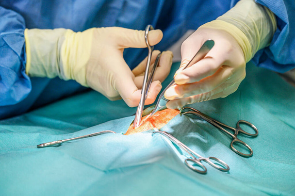 Зблизька, Руки професійного хірурга, роблять операцію. У приміщенні сучасних лікарень. - Фото, зображення