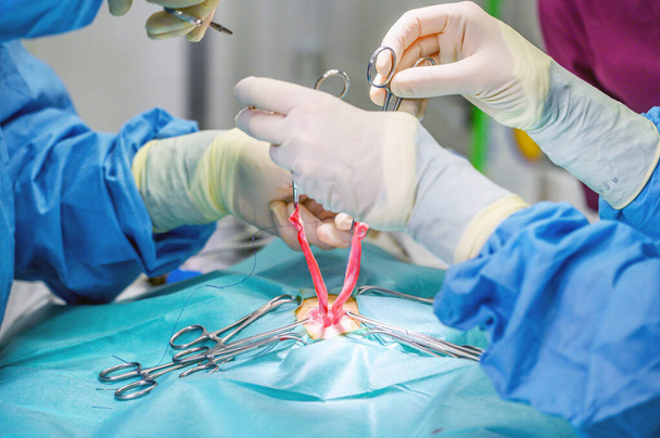 Close-up, Hands of the Professional Surgeon, doing surgery. In the Background Modern Hospital Operation Room. - 写真・画像
