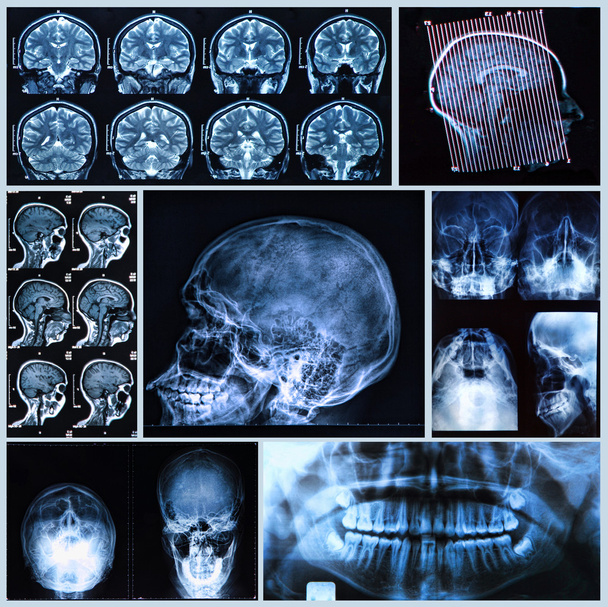 Anatomie van het hoofd en de nek - Foto, afbeelding