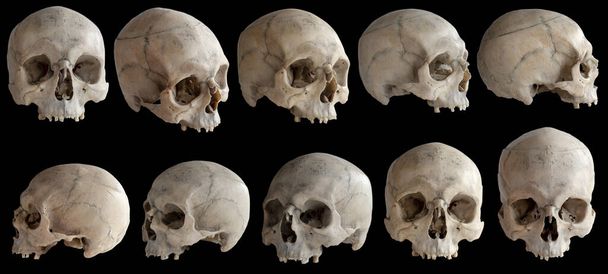Anatomía humana. Un cráneo humano sin mandíbula. Colección de rotaciones del cráneo. Cráneo en diferentes ángulos. Aislado sobre fondo negro
. - Foto, Imagen