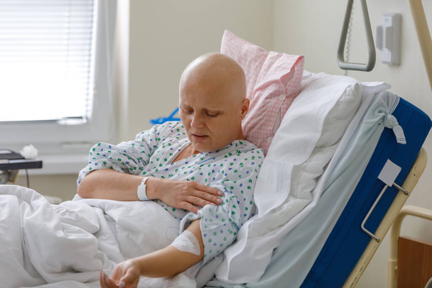 Middle age woman without hair after chemotherapy patient lying at hospital bed feeling sad and depressed worried. Disease feeling sick in health care and clinical attention concept. - Fotoğraf, Görsel