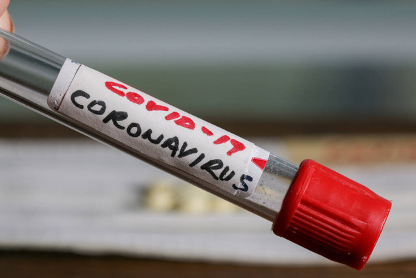 Coronavirus alias COVID -19 texto en tubo sanguíneo
 - Foto, imagen