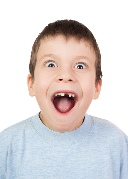 хлопчик з втраченим зубом відкритим ротом
 - Фото, зображення