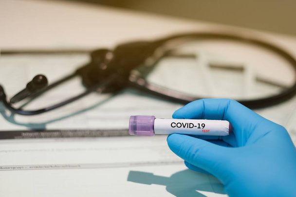 COVID-19 лабораторний аналіз крові, концепція фонового коронавірусу
  - Фото, зображення