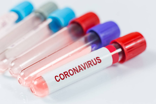 Coronavirus sample testing in lab - Φωτογραφία, εικόνα