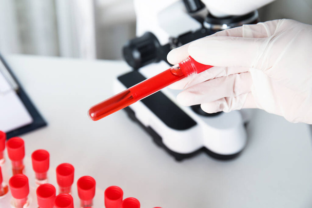 Scientist holding test tube with blood sample in laboratory, closeup. Virus research - Φωτογραφία, εικόνα