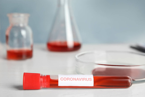 Δοκιμαστικός σωλήνας με δείγμα αίματος και ετικέτα Corona Virus στο τραπέζι στο εργαστήριο - Φωτογραφία, εικόνα