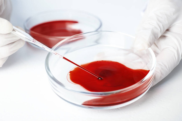 Scientist taking blood sample from Petri dish with pipette in laboratory, closeup. Virus research - Fotografie, Obrázek