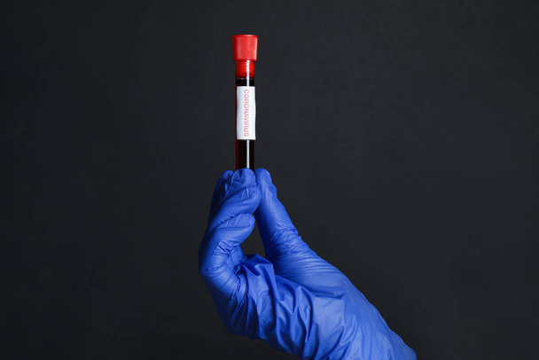 Scientist holding test tube with blood sample and label CORONA VIRUS on black background, closeup - Photo, image