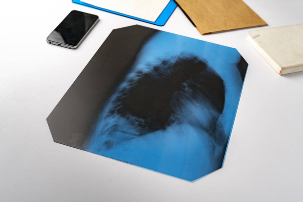 lastra piatta medico radiografia delle ossa, ricerca di diagnosi sul tavolo dell'infermiera
 - Foto, immagini
