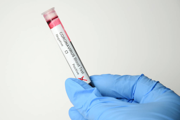 pozitivní koronavirový krevní test - Fotografie, Obrázek