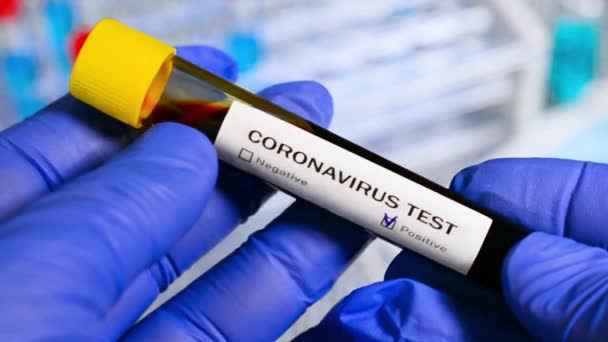 Coronavirus blood test in hospital laboratory - Footage, Video