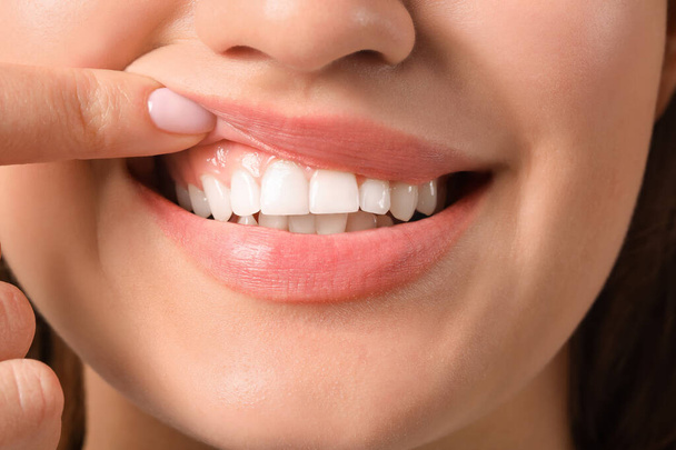 Young woman with healthy gums, closeup - Фото, изображение