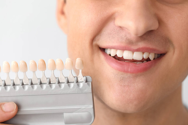 Человек с образцами цвета зубов на светлом фоне, крупным планом
 - Фото, изображение