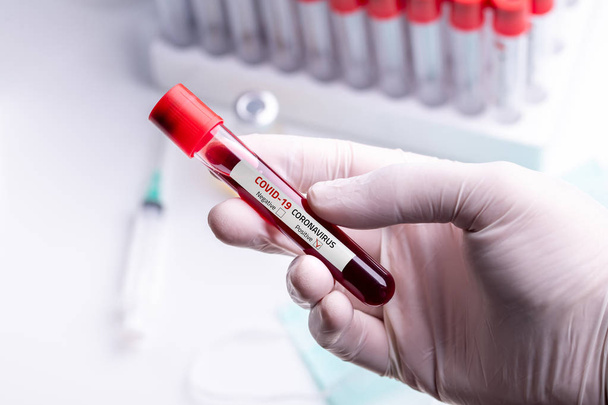 Medico indossando guanti medici in possesso di un tubo sanguigno con Coronavirus positivo 2019-nCoV Campione di sangue
. - Foto, immagini