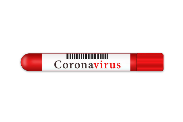 Tesztcső fehér alapon a 2019-nKoV coronavirus eredményével.Pandémiás fertőzés koncepció - Fotó, kép