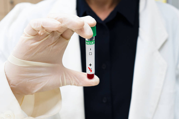 mão do médico segurando teste de tubo de sangue que revelou resultado positivo no fundo branco
 - Foto, Imagem