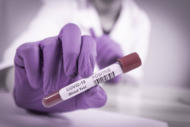 Rurka do pobierania próbek krwi zakażona koronawirusem - Zdjęcie, obraz