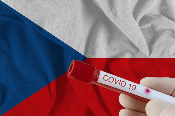 Δείγμα αίματος με COVID-19 Coronavirus κινεζική λοίμωξη της Τσεχικής Δημοκρατίας με εξέταση σε εργαστήριο ιατρικών εξετάσεων - Φωτογραφία, εικόνα