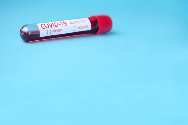 Bloedtest op positief of negatief resultaat. Coronavirus Ziekte 2019 bloedanalyse concept. Testbuis met bloedmonster voor Covid-19. Positief of negatief. Nieuwe ziekte: Covid-19 - Foto, afbeelding