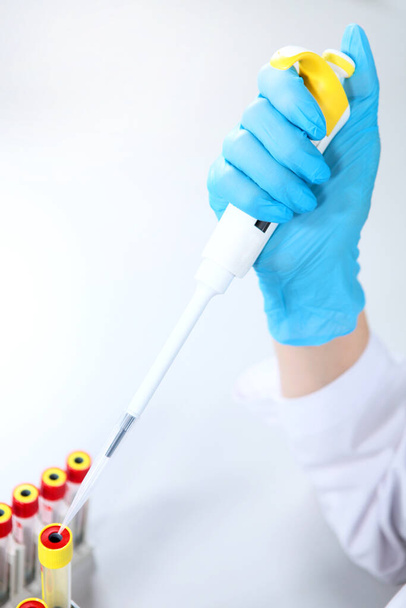 Hands in medical gloves with a pipette. 2019-nCoV. Chemical analysis studies. The threat of a coronavirus epidemic.Copy of the space. Top view - Foto, immagini
