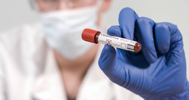 Coronavirus infected blood sample tube - Valokuva, kuva