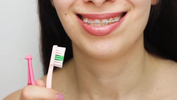 Twee soorten borstel voor het reinigen van tanden met tandbeugels. Haakjes op de tanden na het bleken. Zelfklevende beugels met metalen banden en grijze elastieken of elastiekjes voor een perfecte glimlach. Orthodontische tandbehandeling. - Video