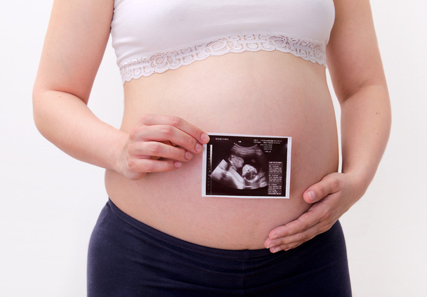 超音波写真と妊娠中の女性 - 写真・画像