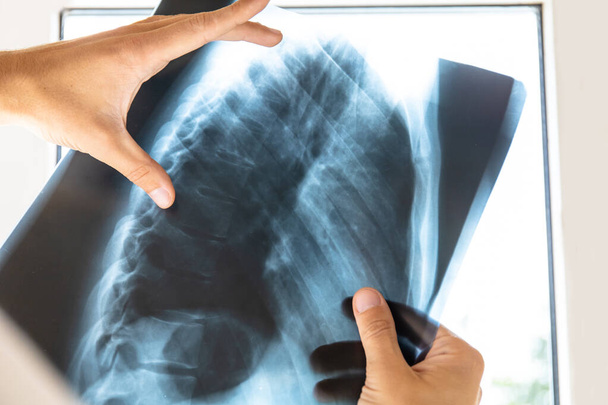 médico examina imagem de raio-x da coluna vertebral humana e peito
 - Foto, Imagem