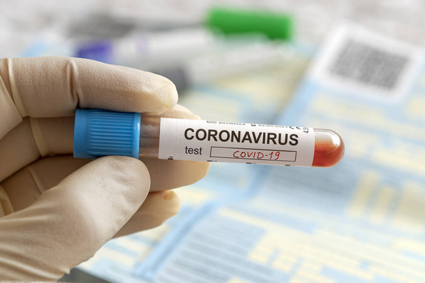 Nurse holding a positive blood test result for the new rapidly spreading Coronavirus, originating in China. lettering on the label coronavirus test covid-19, - 写真・画像