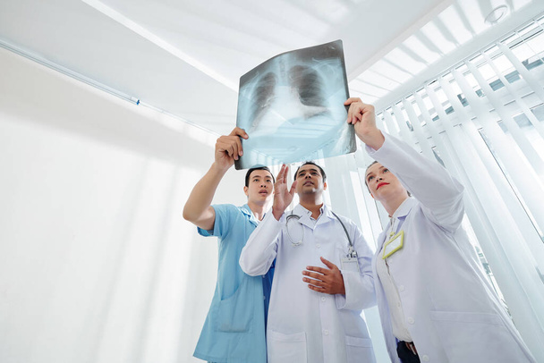 Seriöse Ärzte halten eine Röntgenaufnahme der Brust einer Person in der Hand und versuchen erste Anzeichen einer unheilbaren Krankheit zu finden - Foto, Bild