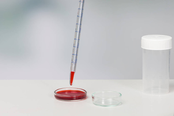 Nahaufnahme medizinischer Laborarbeiten an Sonden in einer Petrischale - Foto, Bild