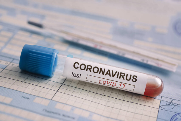tubo de ensayo con el análisis de sangre está en la mesa junto a los documentos. Prueba positiva para coronavirus covid-19. concepto de luchar contra una peligrosa enfermedad china
. - Foto, Imagen