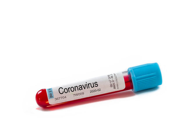 Macro blood sample in test tube on white background. Epidemic Mers-CoV Coronavirus researching and treatment concept - Φωτογραφία, εικόνα