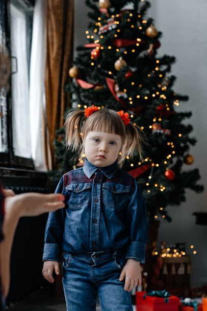 Little emotional girl. Baby features Down Syndrome. Disabled children. - Fotó, kép