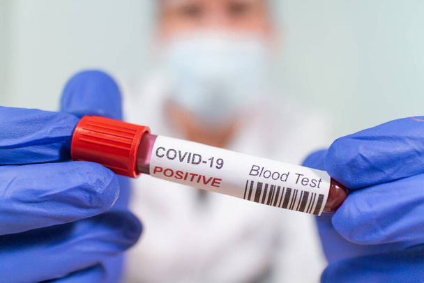 Tubo de muestra de sangre infectado con Coronavirus
 - Foto, imagen