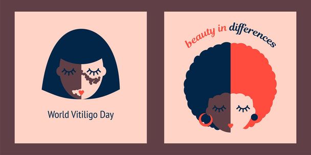 set of two illustrations of a woman with vitiligo on a light background. world vitiligo day. beauty in differences - Vector, Image