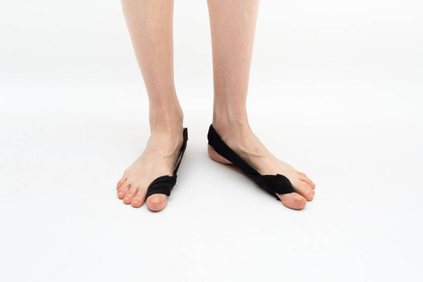  stabilizing orthosis for the correction of the big toe on the woman legs when hallux valgus, 2 legs, close-up isolated, white background - Photo, image