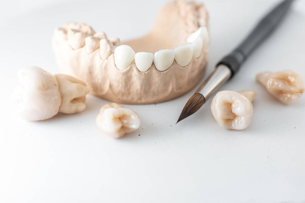 Model of artificial jaw with teeth - Foto, afbeelding