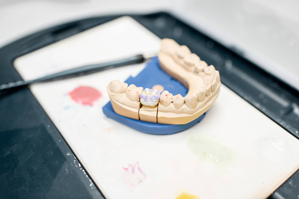 Colored dental prosthesis in the laboratory - Fotografie, Obrázek