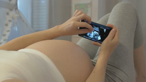 Exame ultra-sonográfico do feto nas mãos de uma mulher grávida
 - Filmagem, Vídeo